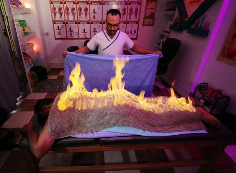 Αιγύπτιος μασέρ βάζει φωτιά στους πελάτες του για να απαλύνει τον μυϊκό τους πόνο – Εφαρμόζει τεχνική των «Φαραώ» (Video)